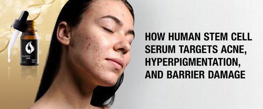 Majestic Skin Human Stem Cell Serum – Clinical-Level Treatment for Acne, Hyperpigmentation, and Barrier Repair
