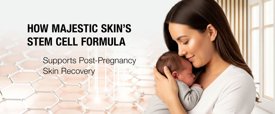 Post-pregnancy skin recovery before and after results using stem cell face serum and wrinkle reduction serum treatment