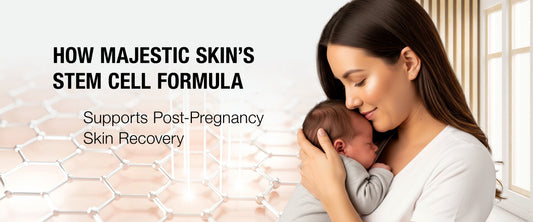 Post-pregnancy skin recovery before and after results using stem cell face serum and wrinkle reduction serum treatment