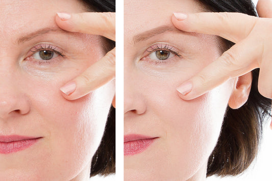 Before and after photo of a woman in her 40s showing visible reduction in wrinkles and improved skin tone after using Majestic Skin human stem cell serum