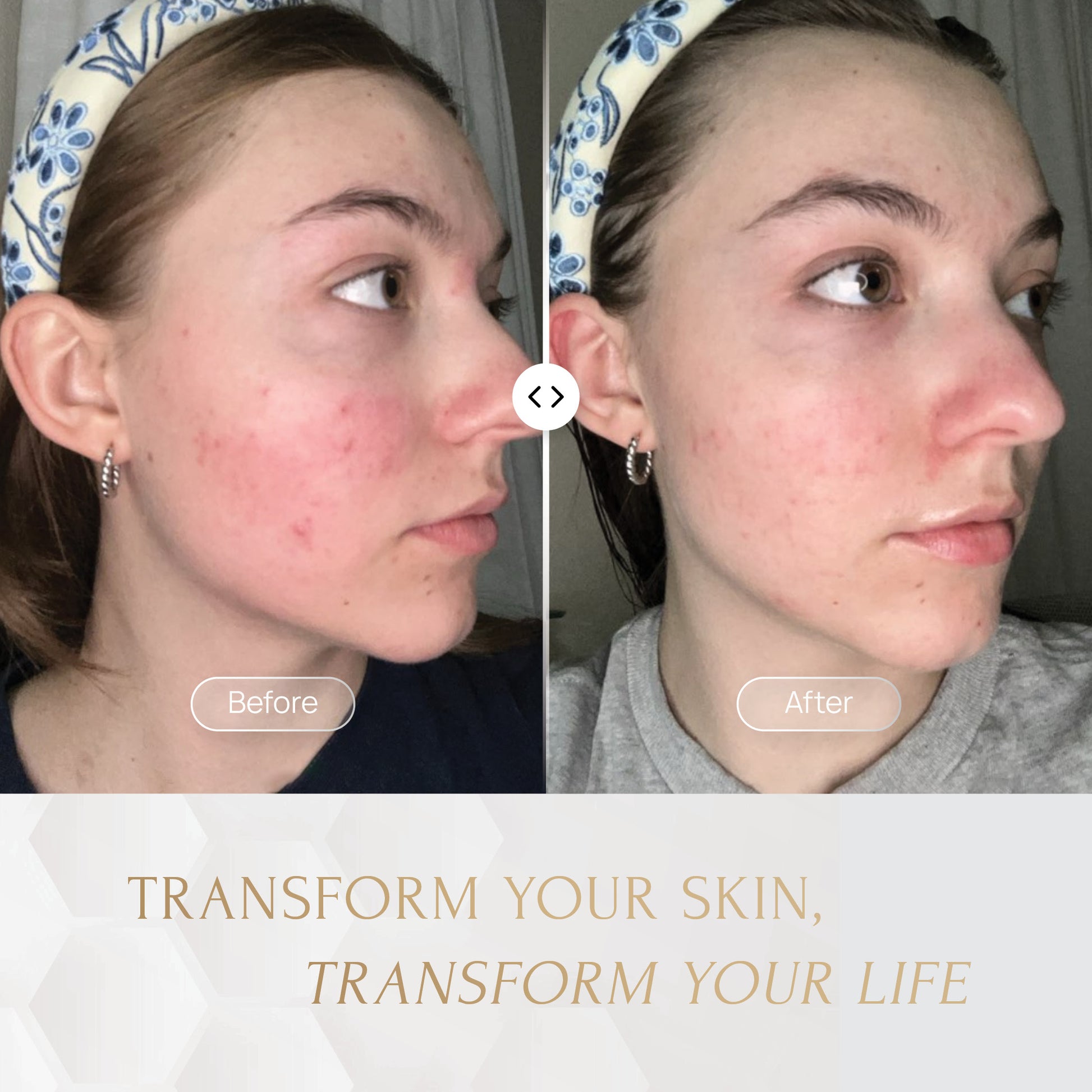 Majestic Skin 5ml Serum Default Title Majestic Cosme