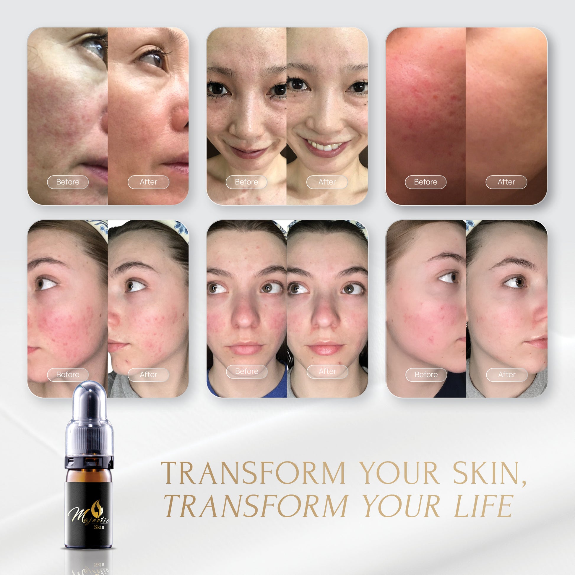 Majestic Skin 5ml Serum Default Title Majestic Cosme