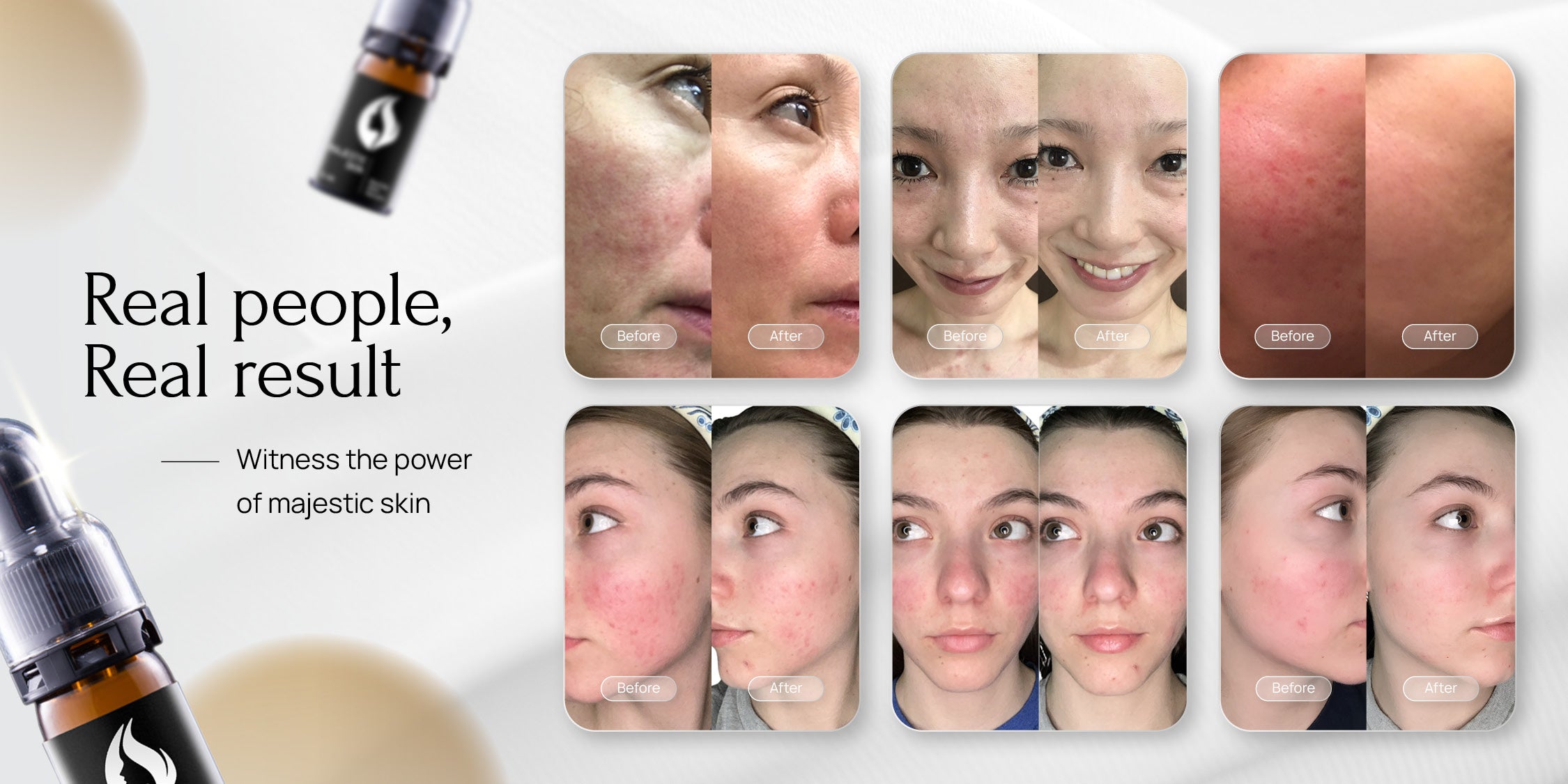 best face treatment for wrinkles - before and after images