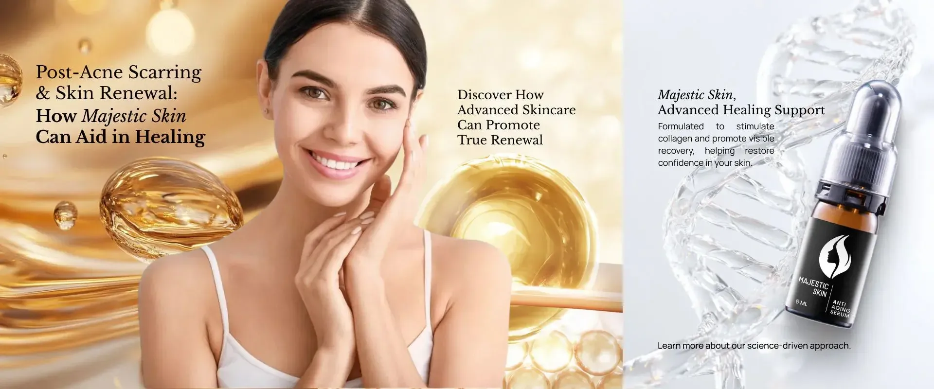 Post-Acne Scarring & Skin Renewal: How Majestic Skin Can Aid in Healing