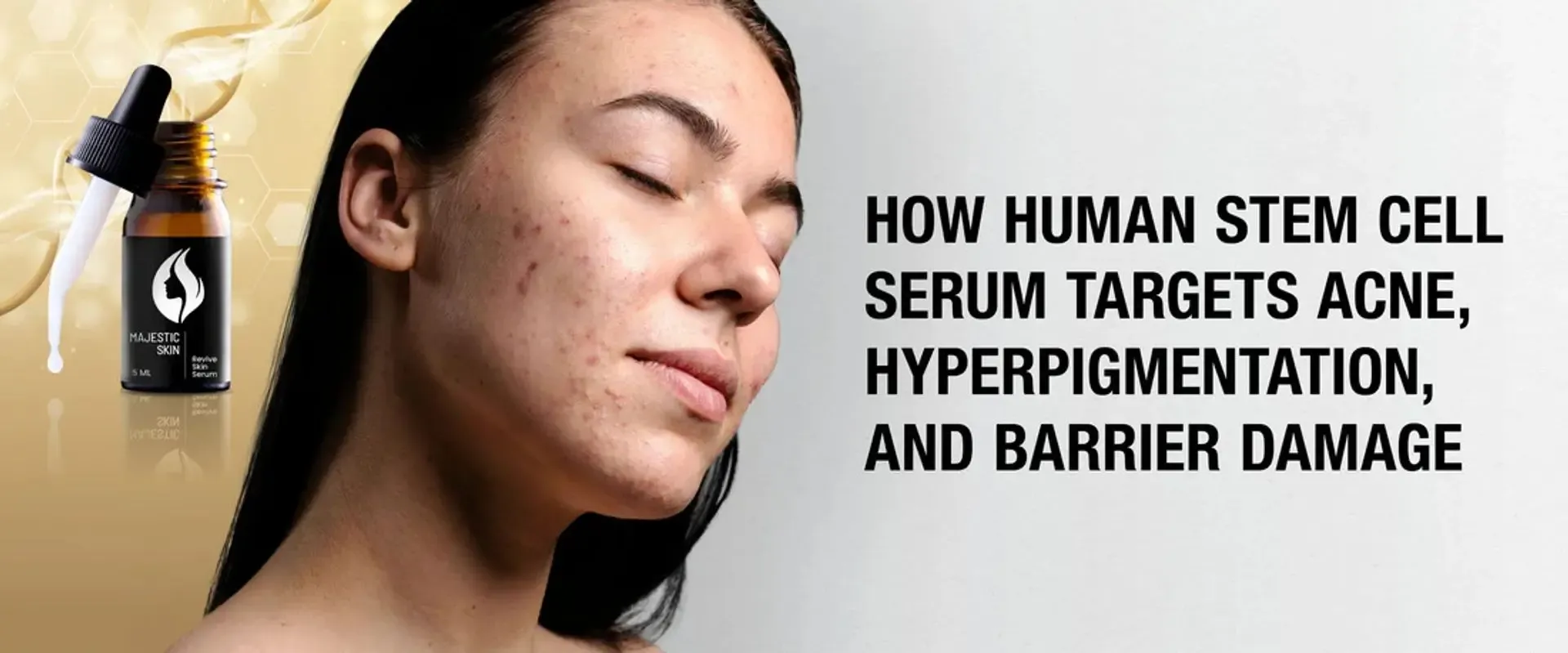 Bagaimana Serum Regeneratif Mengatasi Jerawat, Hiperpigmentasi, dan Kerusakan Skin Barrier