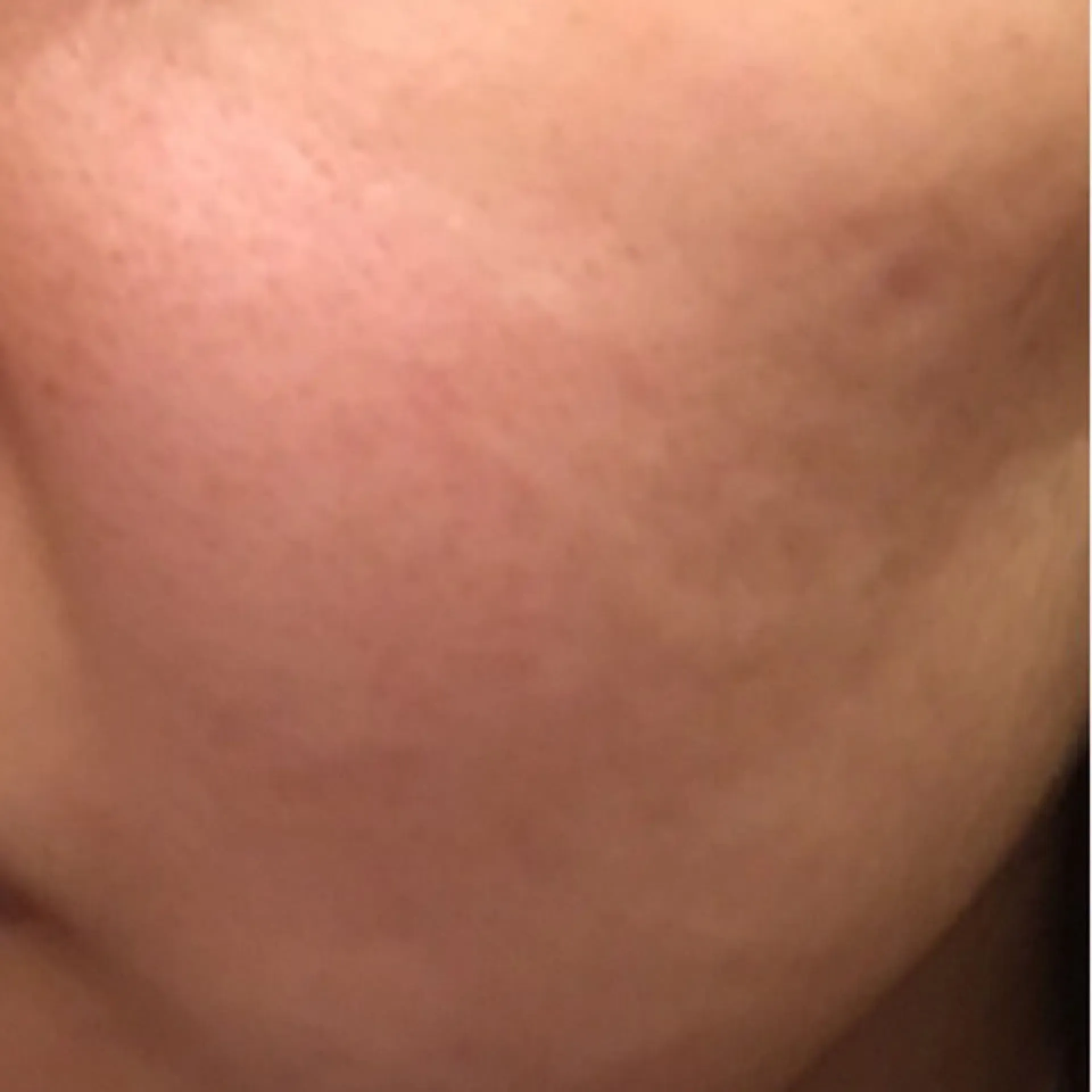 Image · result 2 after