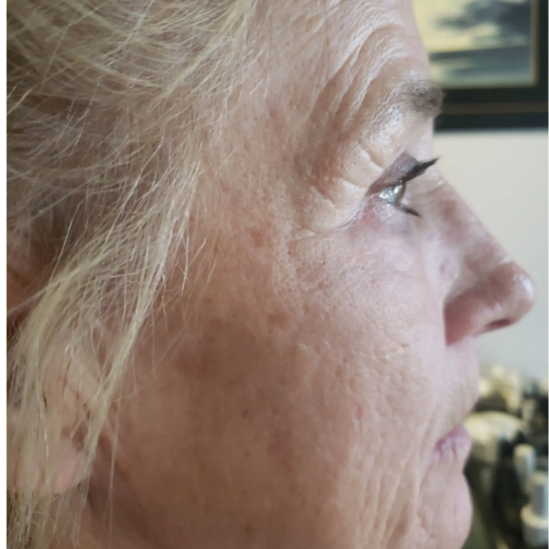 Image · result 2 before