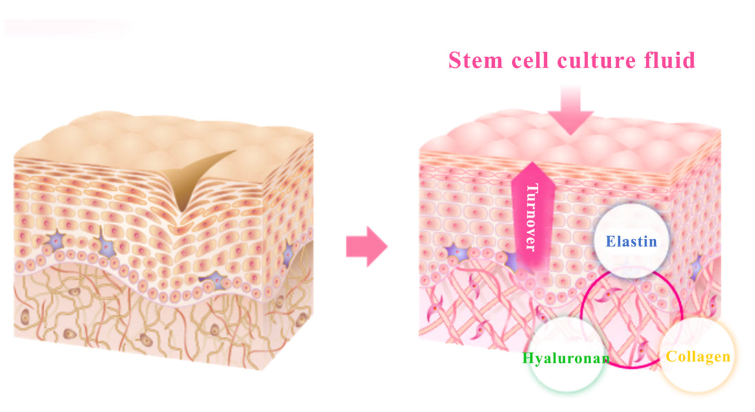 The Science Behind Majestic Skin's Anti aging serum EGF, FGF, and Human Stem Cell Infusion