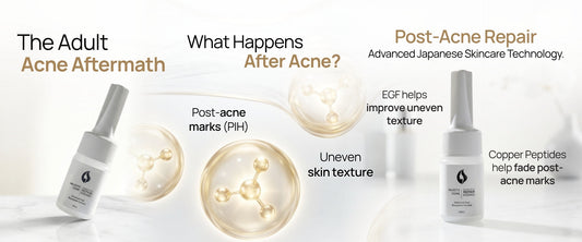 Majestic Active Repair Essence skincare from Japan EGF Copper Peptide post-inflammatory hyperpigmentation PIH repair uneven skin texture adult acne aftermath